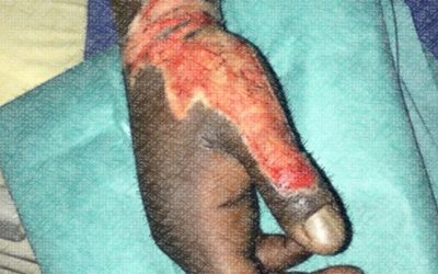 Abdoulaye, agressé par la police à Mantes la Jolie le 7 novembre 2017